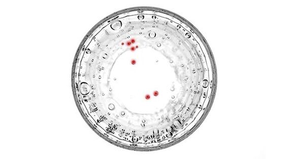 Se hai sintomi di prostatite, dovresti fare il test per le infezioni nascoste.